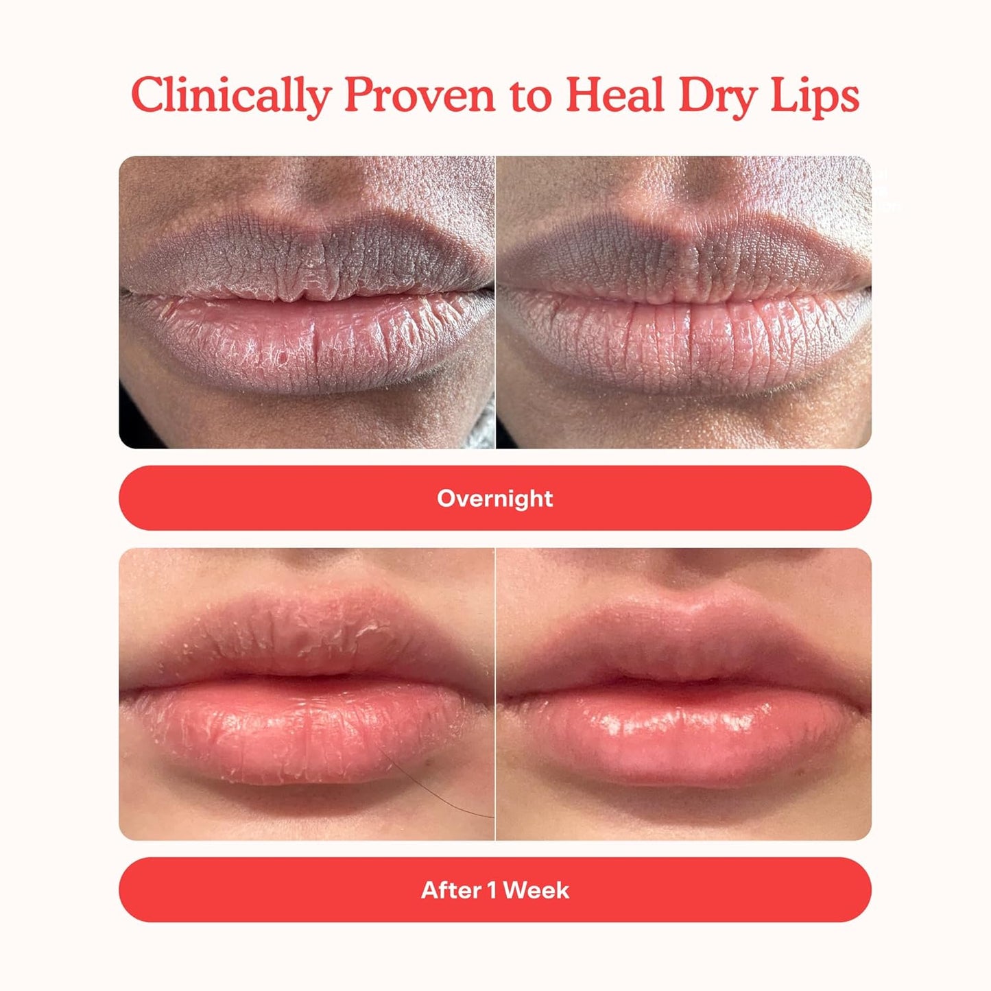 Tower 28 LipSoftie Hydrating Tinted Lip Treatment Balm, Moisturizing Lip Mask for Chapped Lips